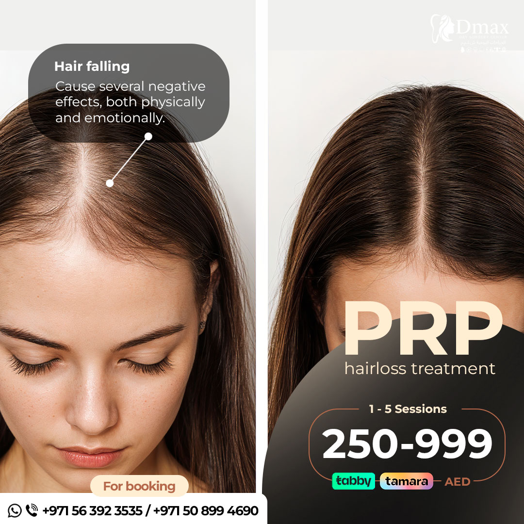 Hair PRP for Female